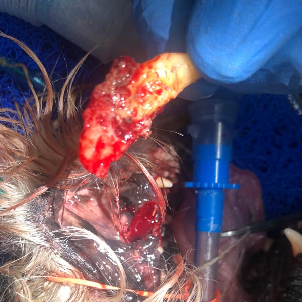 Extracted Tooth Dental Disease